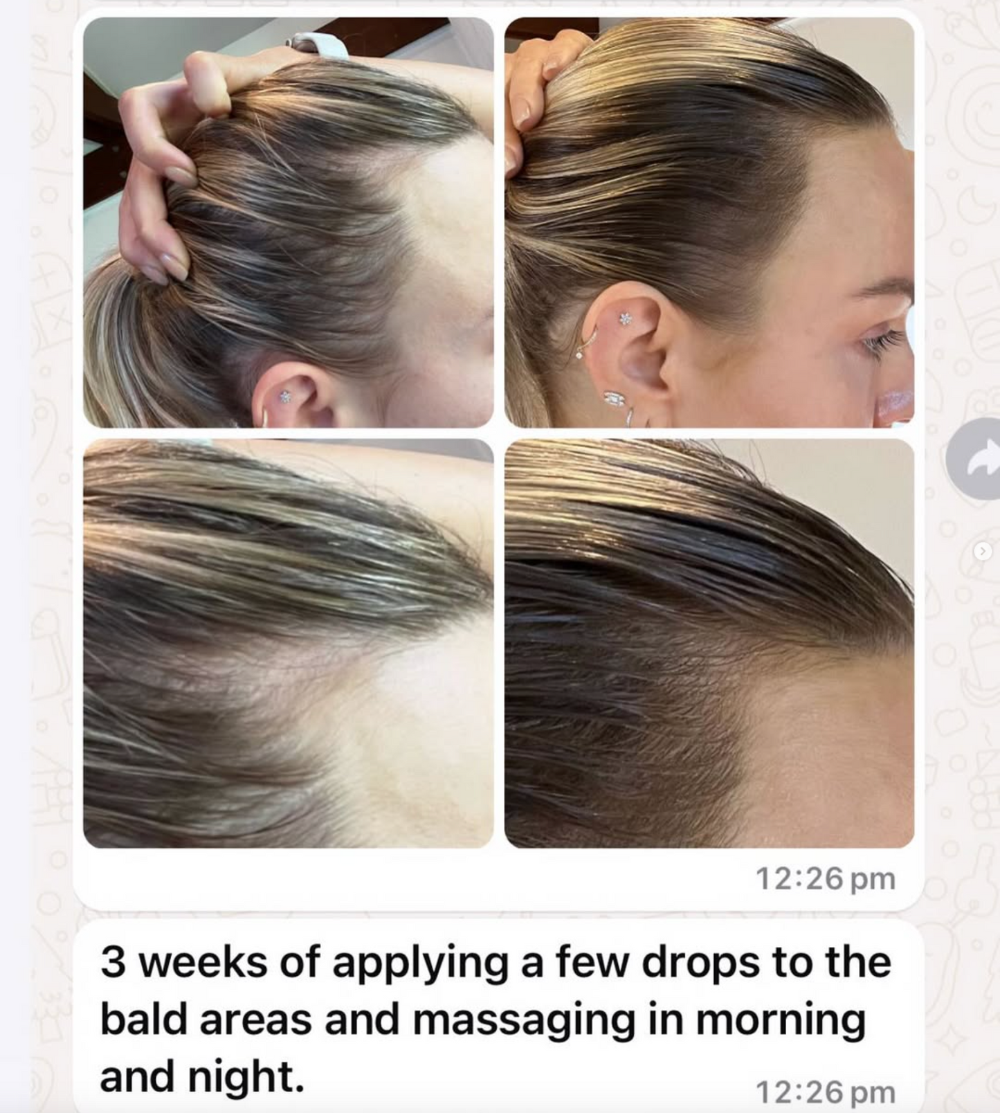 JSHealth Vitamins Au Vita-Growth Scalp Serum