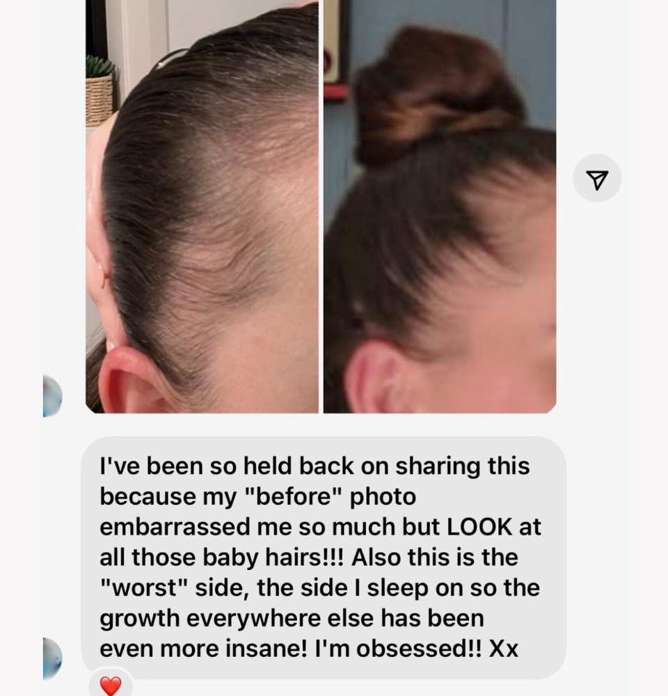 JSHealth Vitamins Au Vita-Growth Scalp Serum